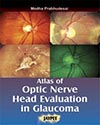 Atlas of Optic Nervehead  Analysis in Glaucoma Book Cover
